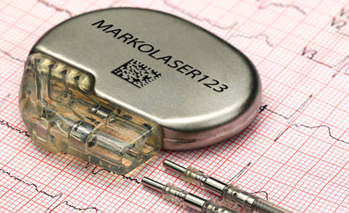 Laser Marking on pace maker